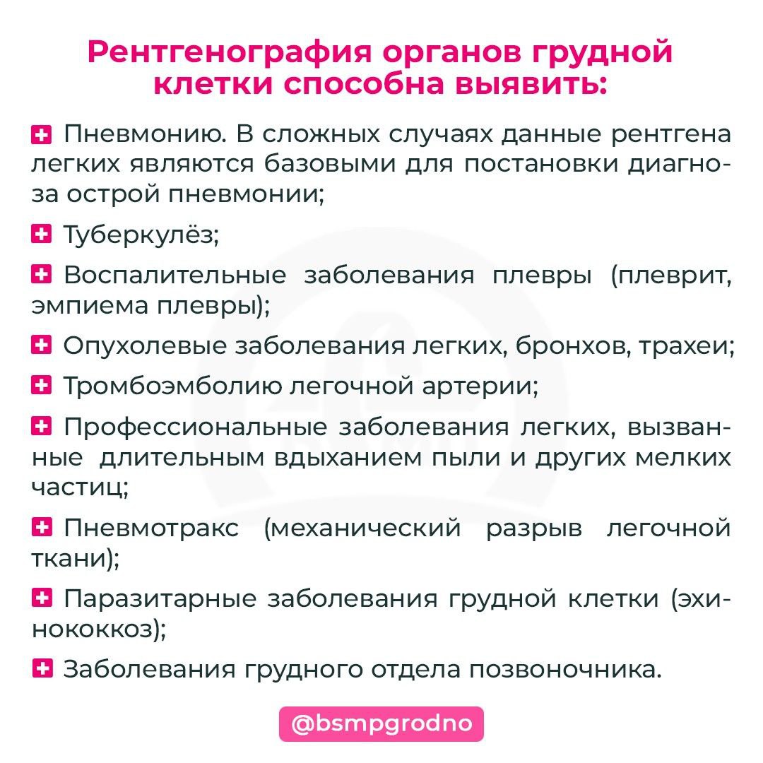 Рентгенография органов грудной клетки - БСМП Гродно